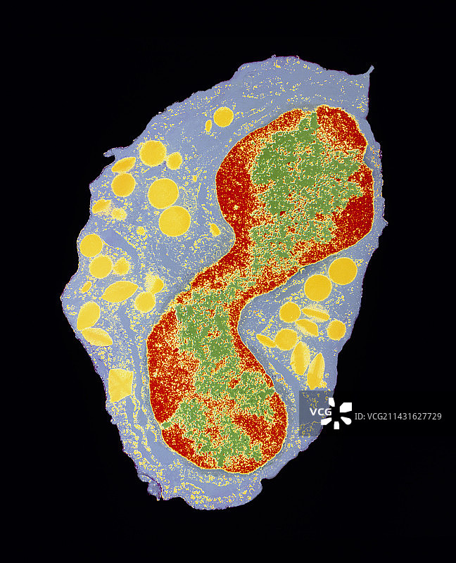 粒细胞白细胞的彩色透射电镜图像图片素材