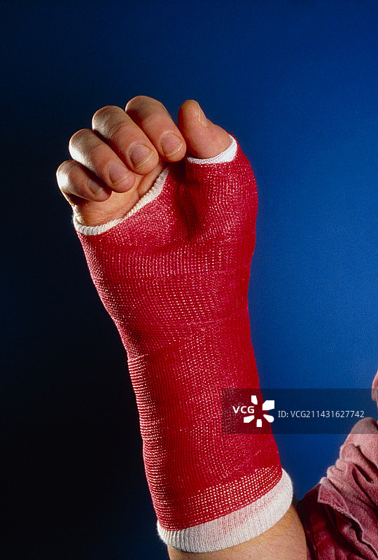 受伤的手腕用玻璃纤维模型包扎图片素材