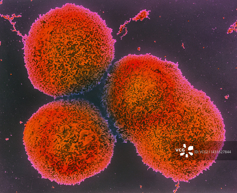 肝细胞彩色扫描电子显微镜图像图片素材