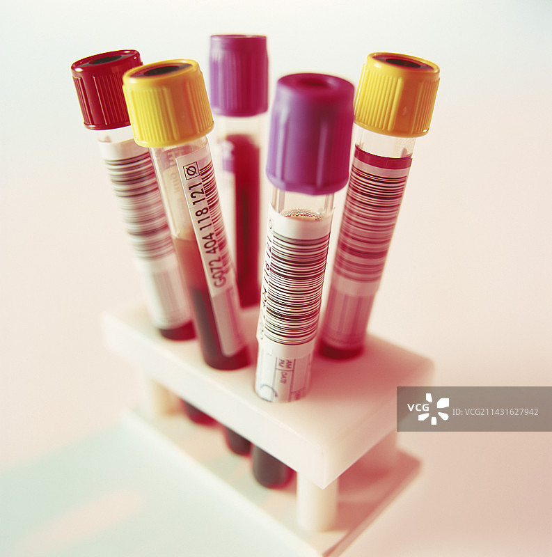 血液样本图片素材