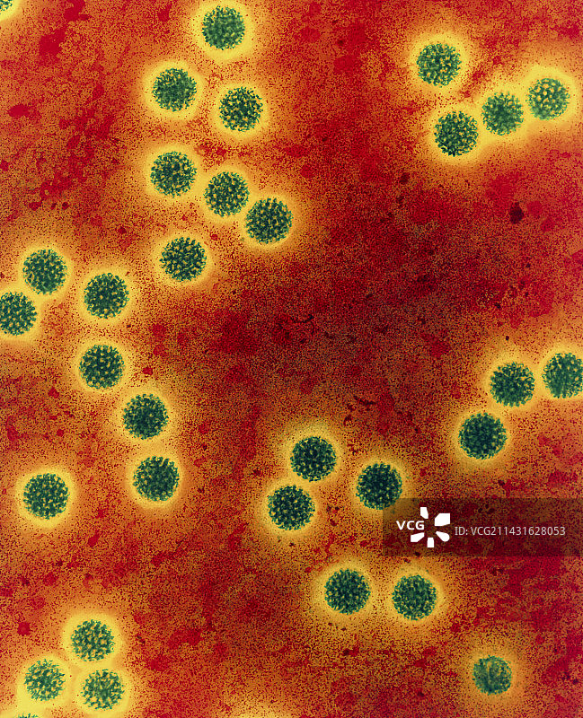 轮状病毒的彩色透射电镜图图片素材