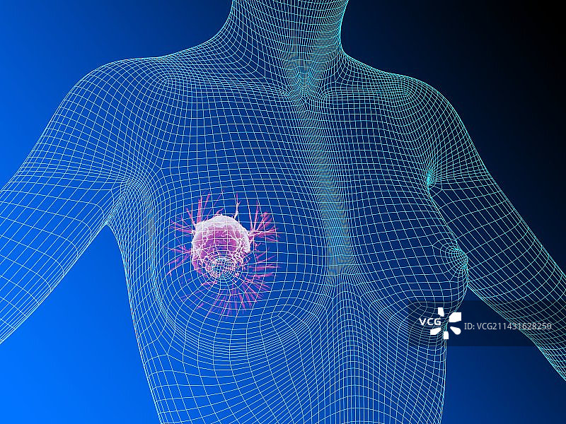 乳腺癌艺术作品图片素材