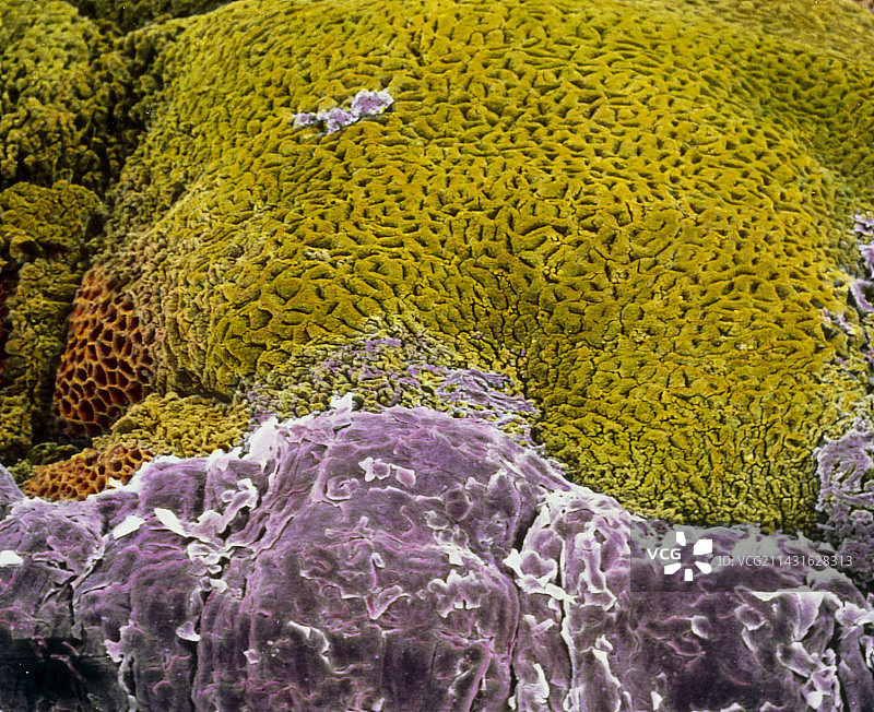 食管-胃过渡带彩色扫描电镜图图片素材