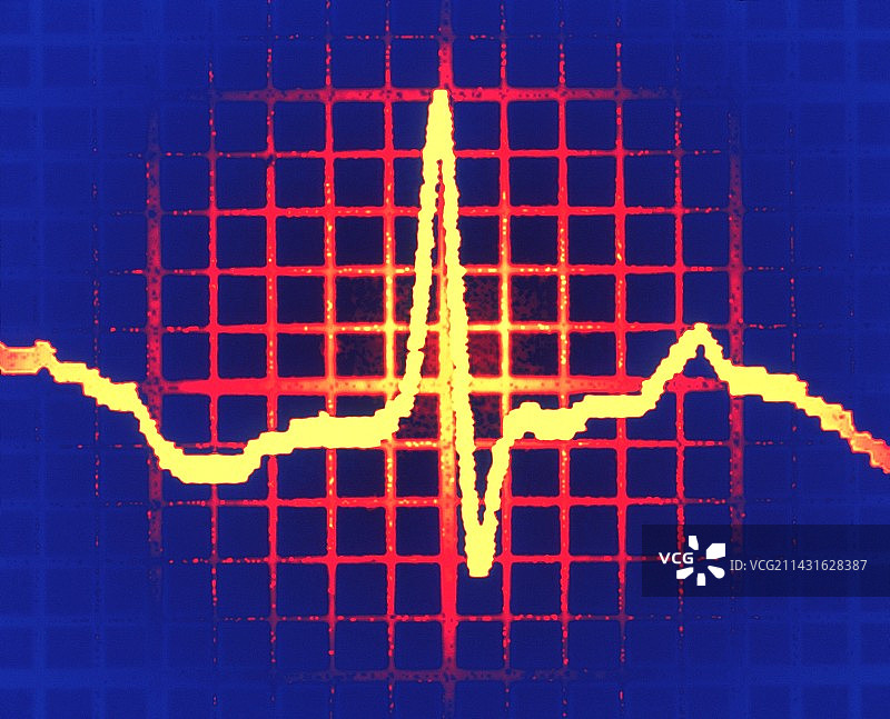 心电图轨迹图片素材