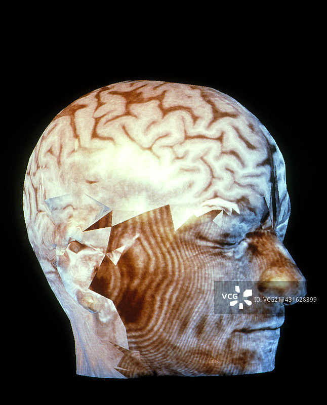 头部彩色3D CT扫描图片素材