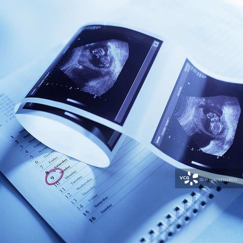 胎儿超声波图片素材