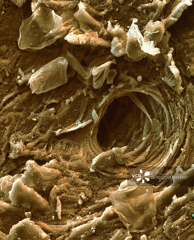皮肤,扫描电镜图片素材