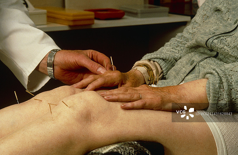 针灸师在膝盖和手上施针图片素材