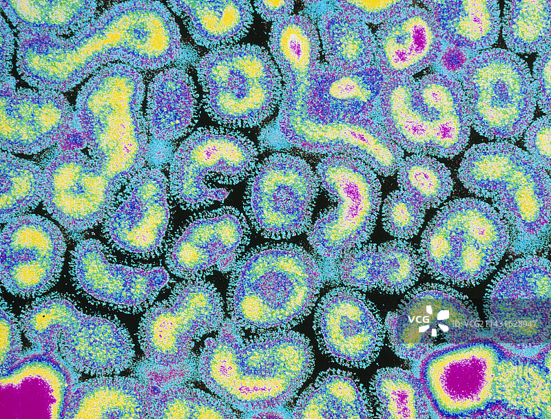 一组流感病毒的彩色透射电镜图片素材