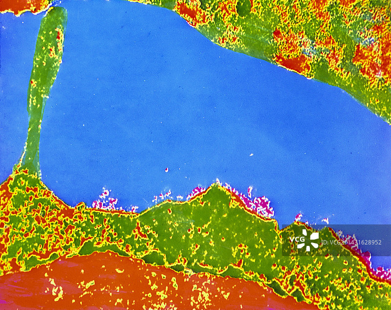 带HLA抗原的人类白细胞的透射电镜照片图片素材
