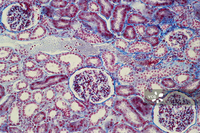 正常人肾脏图片素材