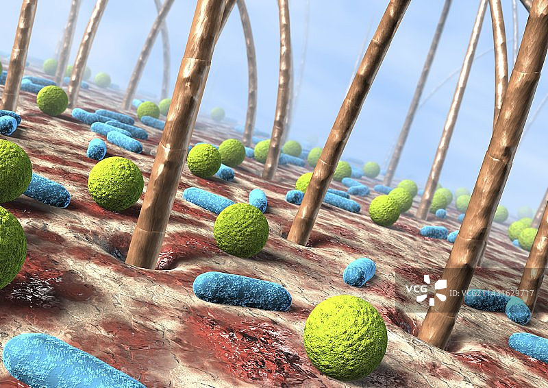 细菌性皮肤感染艺术图图片素材