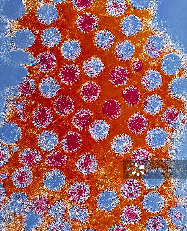 轮状病毒的彩色透射电镜图图片素材