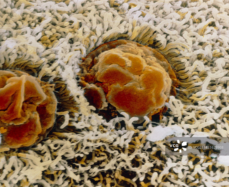 结肠壁上杯状细胞的伪彩SEM图片素材