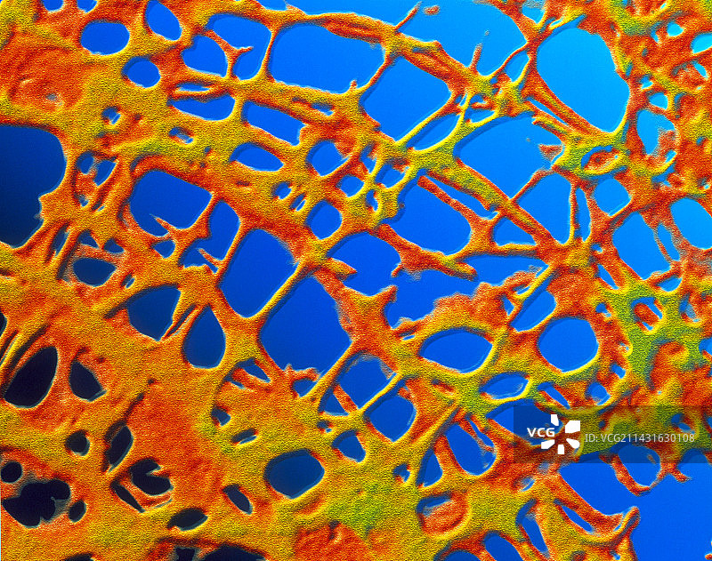 骨质疏松骨图片素材