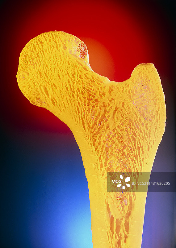 股骨图片素材