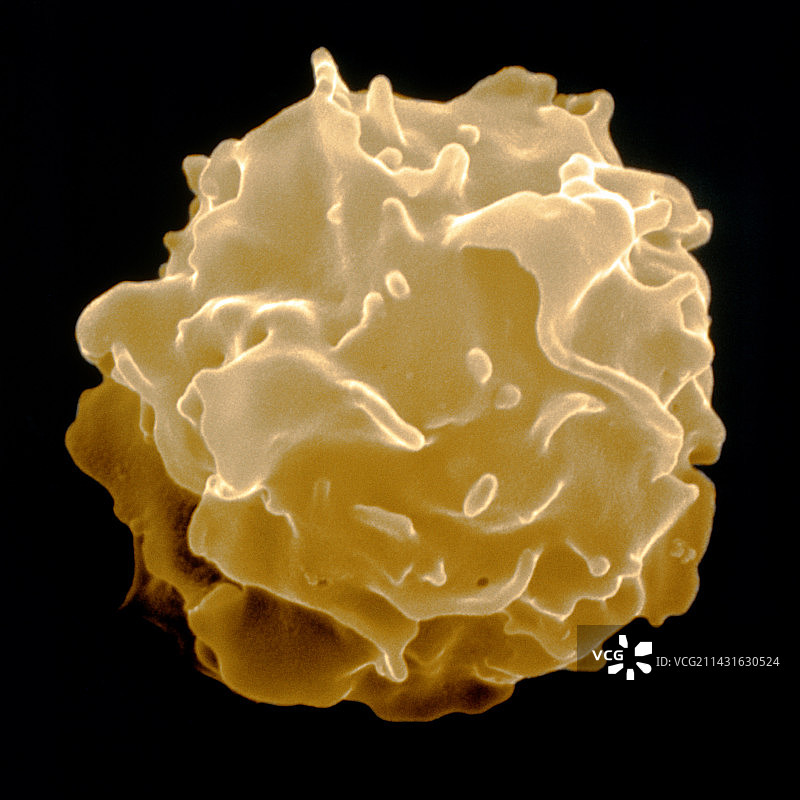 彩色扫描电镜下的人类自然杀伤血细胞图片素材