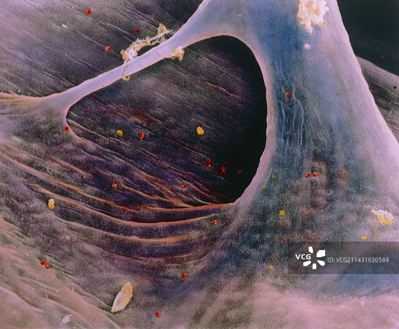 人心的心内膜彩色扫描电镜图像图片素材