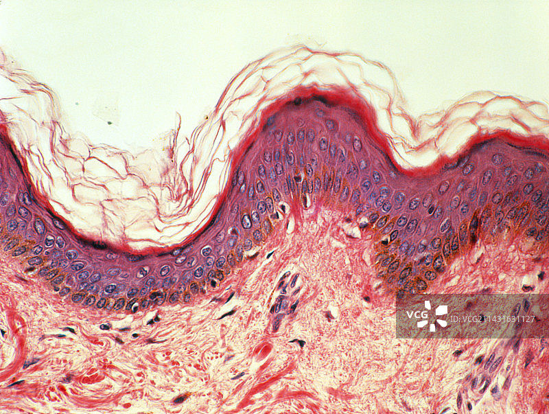 皮肤切面图图片素材