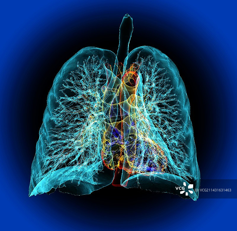 心脏和肺部的3D CT扫描图片素材