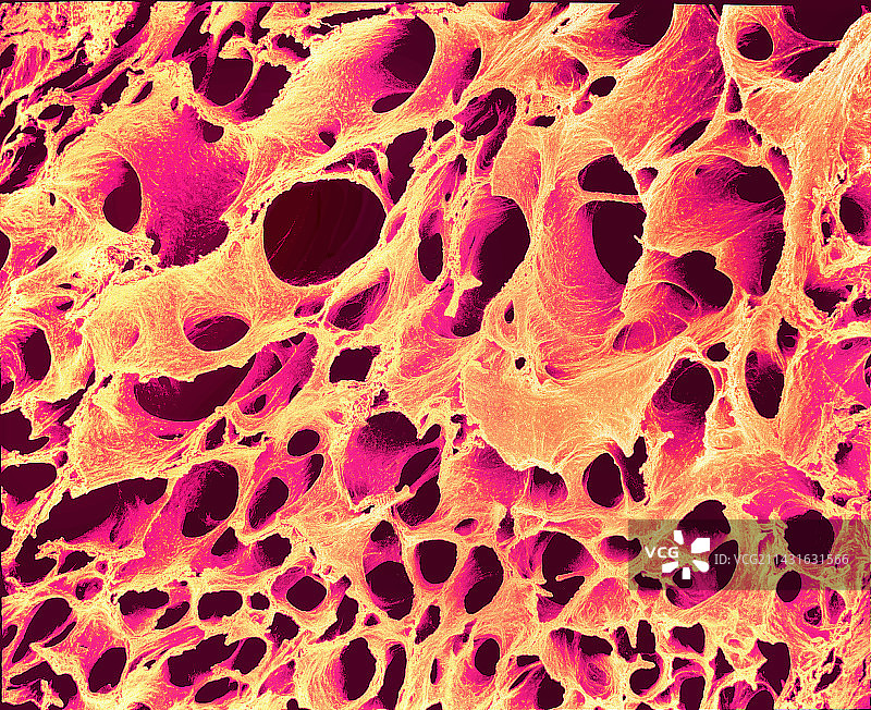 阴茎组织，扫描电镜图片素材