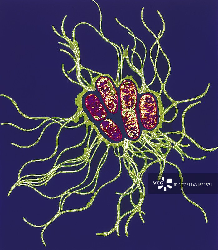 沙门氏菌（透射电子显微镜）图片素材