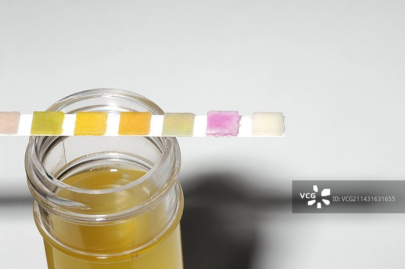 尿液分析图片素材