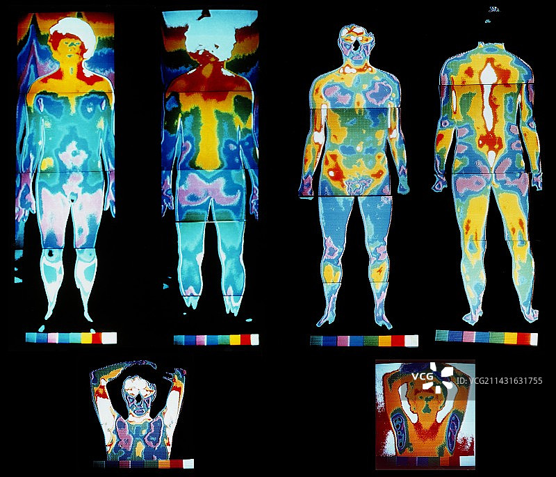 人体热成像图图片素材
