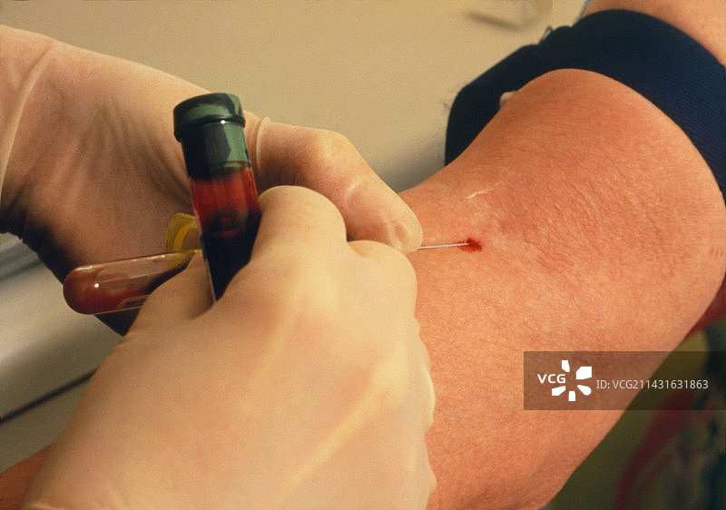 抽取血液进行肝功能检查图片素材