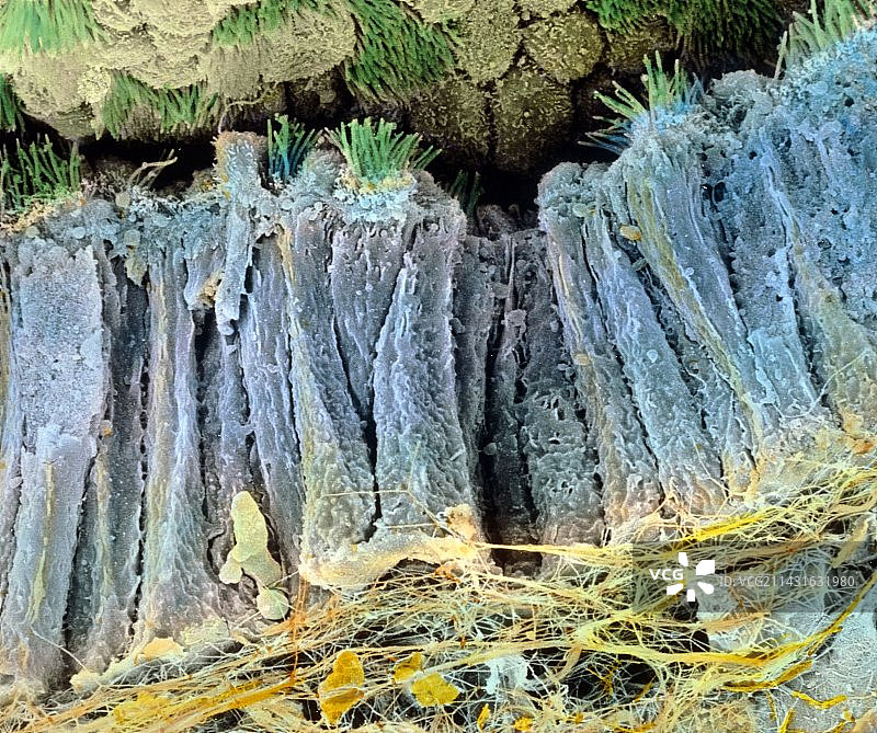 输卵管上皮细胞的彩色扫描电镜图图片素材