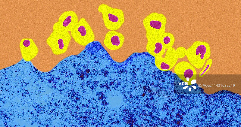 艾滋病毒出芽，透射电镜图片素材