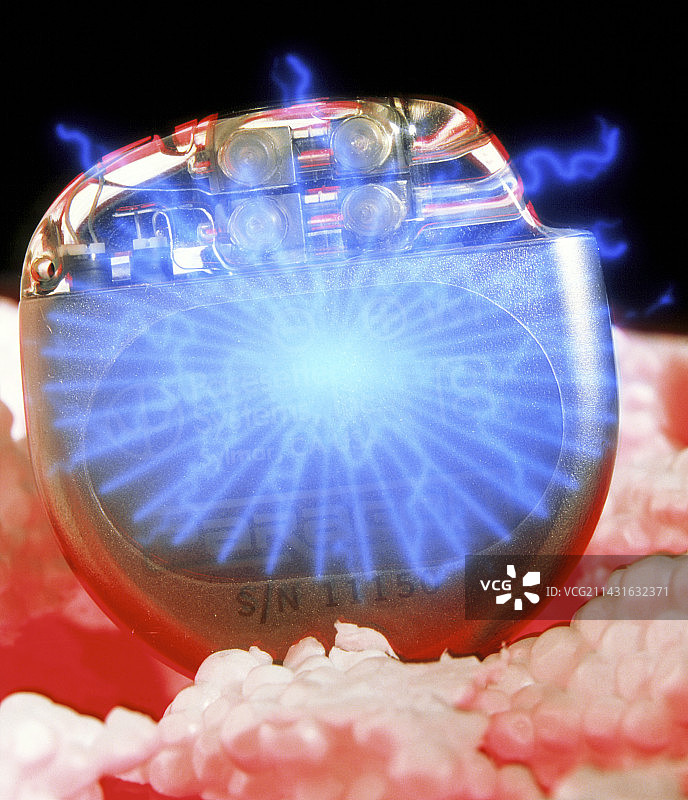 心脏起搏器图片素材