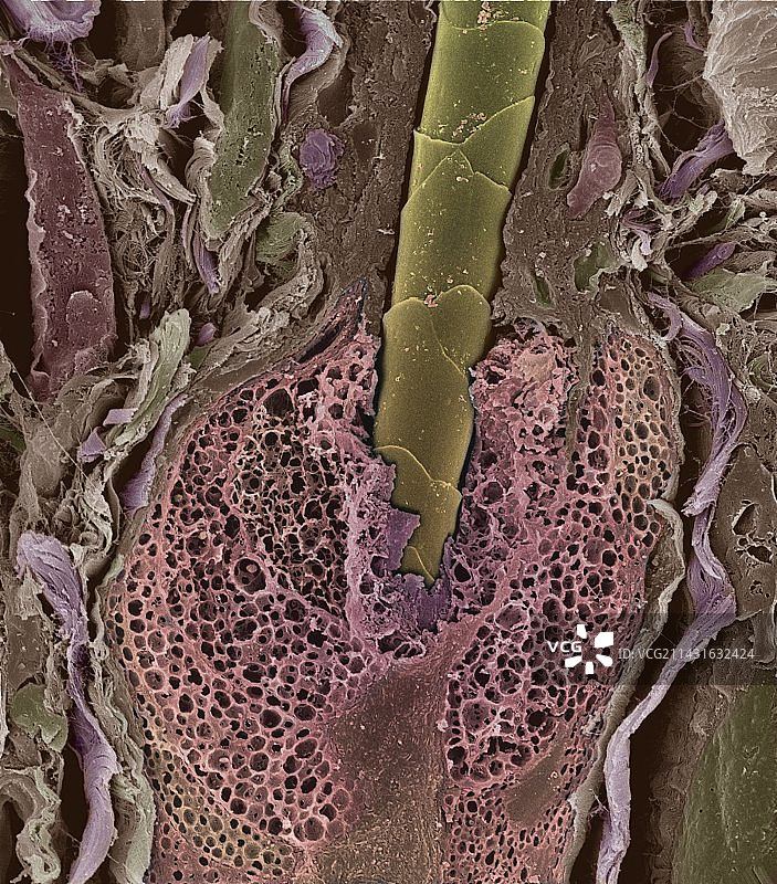 毛囊，扫描电子显微镜图片素材