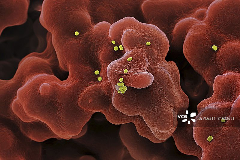 耐甲氧西林金黄色葡萄球菌，扫描电镜图片素材