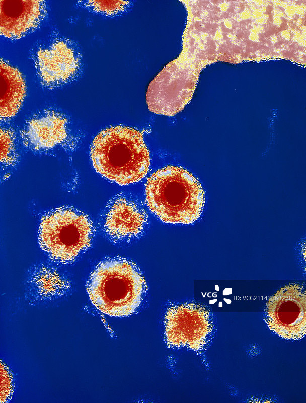 感染细胞的HHV6病毒彩色透射电镜图图片素材