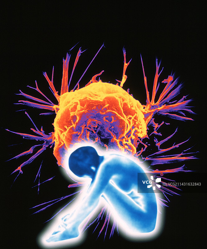 癌症图片素材