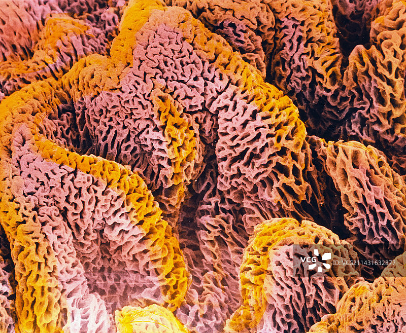 子宫内膜(分泌期)的彩色扫描电镜图片素材