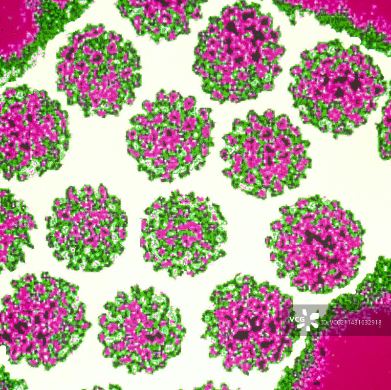 乳头瘤病毒彩色透射电镜图图片素材