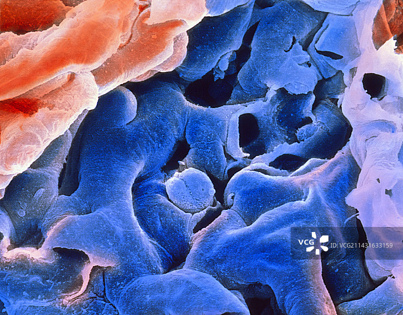 人肺中的肺泡图片素材