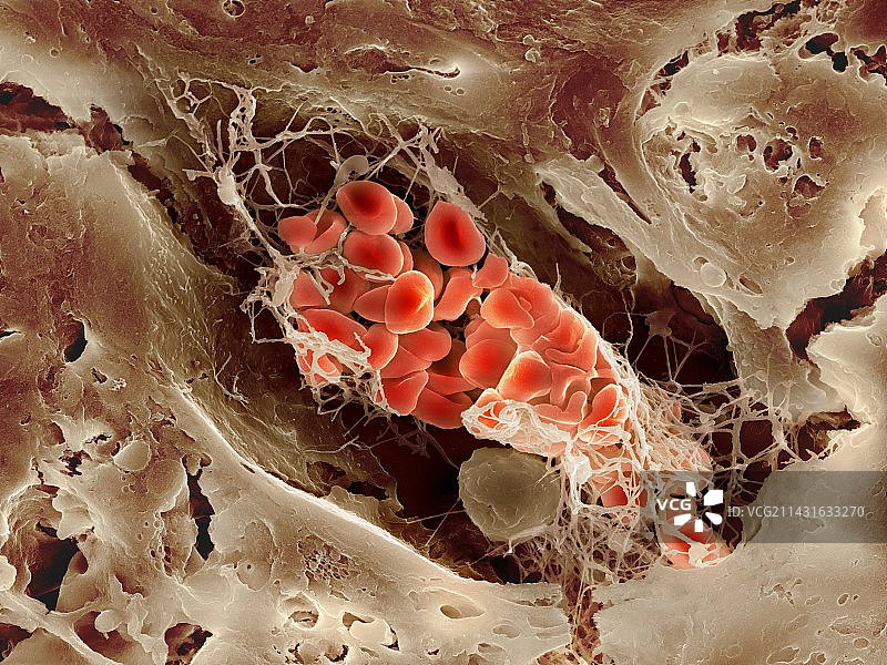 血栓扫描电镜图片素材