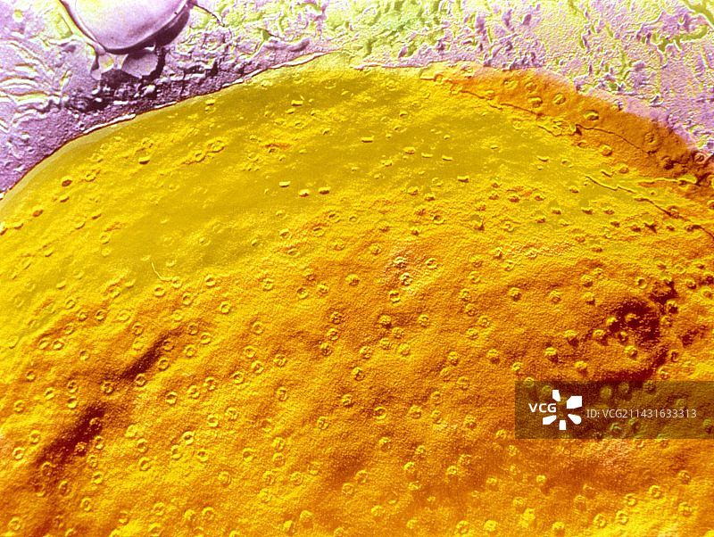 假彩色扫描电镜细胞核图片素材