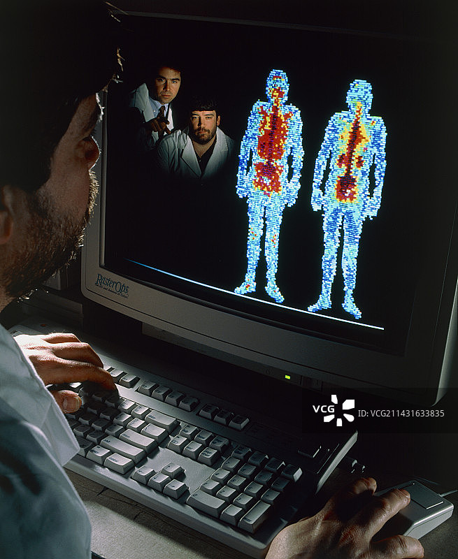 医生研究全身伽马相机扫描图片素材