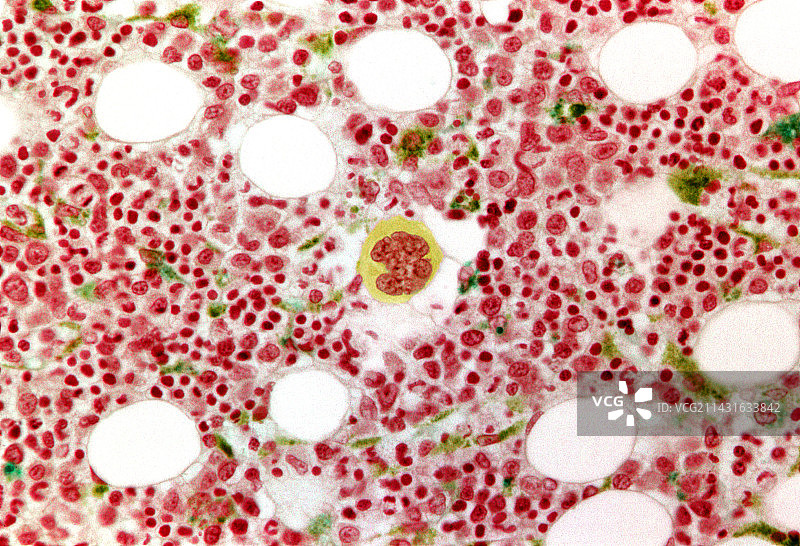 骨髓显微照片图片素材