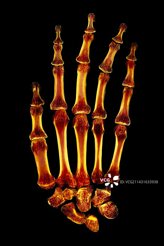 正常人手的彩色X光片图片素材