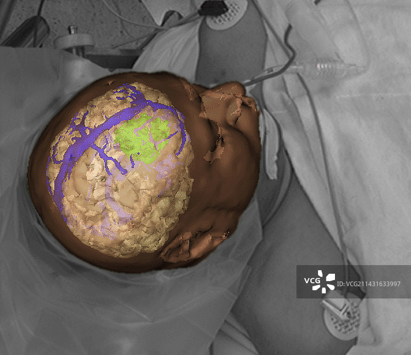 虚拟外科手术图片素材