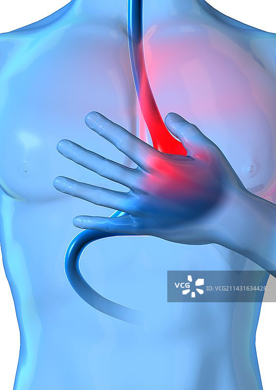 烧心概念艺术品图片素材