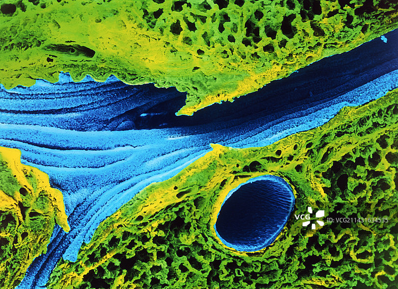 显示肺泡和支气管的彩色扫描电镜图图片素材