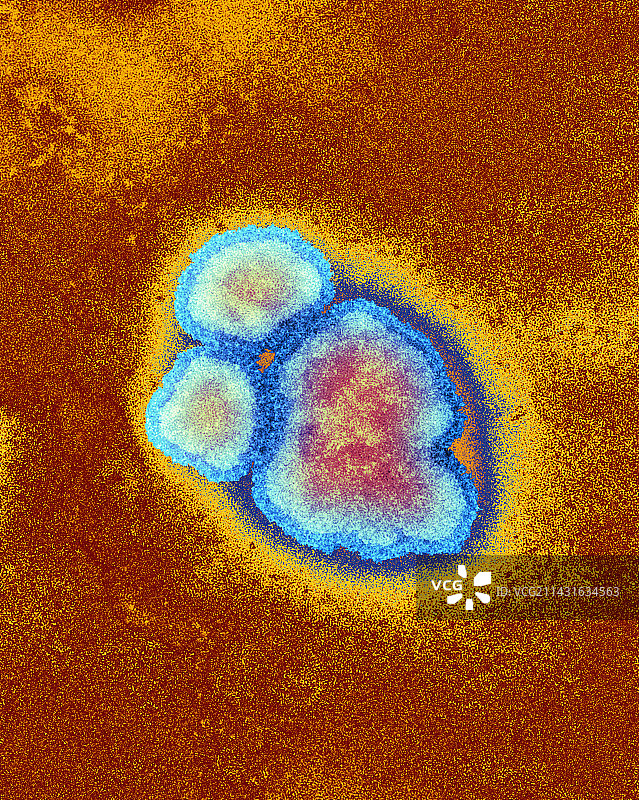 麻疹病毒颗粒，透射电子显微镜图片素材