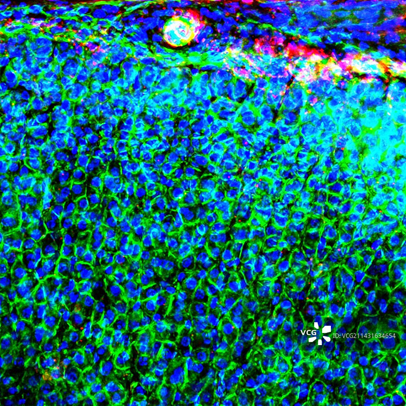 肾上腺荧光显微照片图片素材