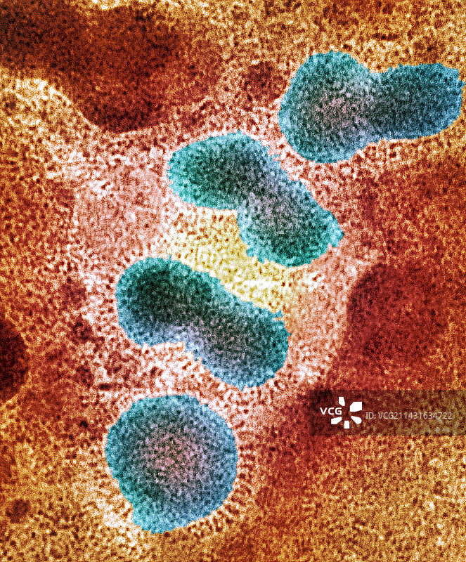 H5N1禽流感病毒颗粒（透射电镜）图片素材